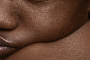 close up of woman with stubborn skin