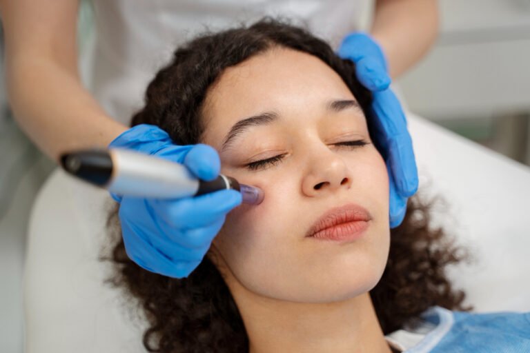 woman recieving microneedling treatment | placeholder for radio frequency ruined my face