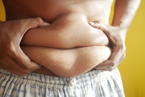 A person holding their stomach, highlighting folds and skin texture against a bright background. | hanging belly fat