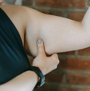 A woman pinches her tricep skin to evaluate body fat in a fitness context. | 3 Targeted Workouts to Firm Up Arms After 60—No More Jiggle!