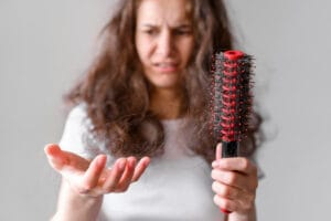 woman suffering from hair loss | The Vitamin That Could Be Causing Your Hair to Fall Out—And Most People Don’t Know It