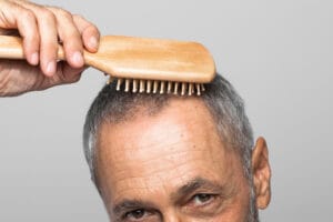 balding man combing hair